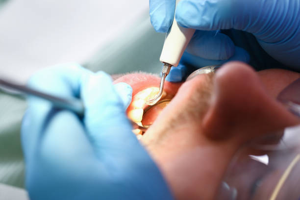Best Walk-In Emergency Dentist in Oskaloosa, IA