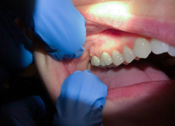 Best Same-Day Emergency Dentist in Oskaloosa, IA