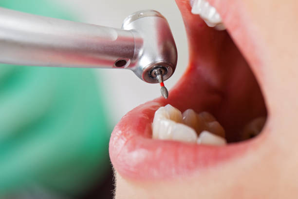 Best Emergency Dental Surgery in Oskaloosa, IA